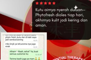 Mengoleskan Phytofresh setiap hari, kutu air di kaki akhirnya mereda.