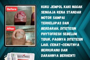 Phyto Fresh wajib ada di rumah
